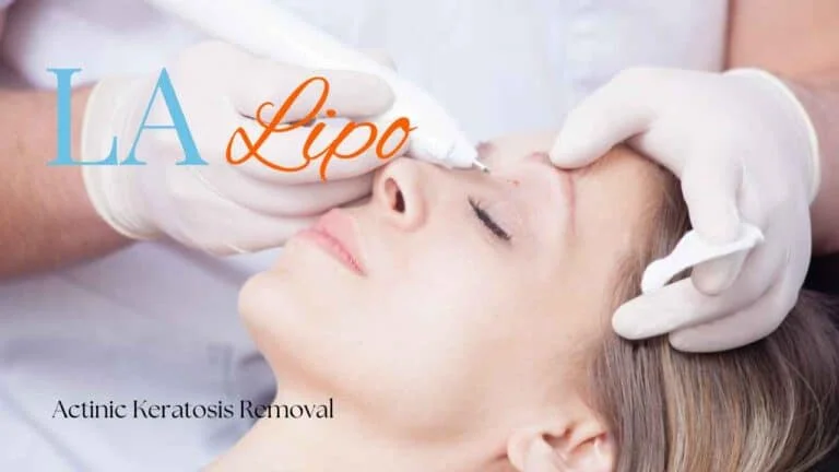 Woman receiving Actinic Keratosis Removal Treatment Wembley
