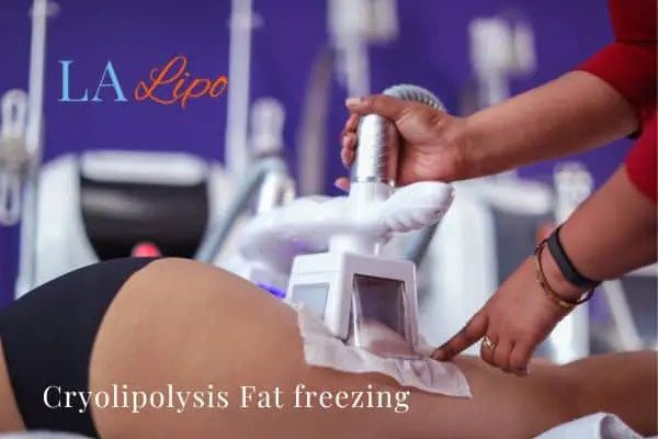 women getting fat freezing Wembley