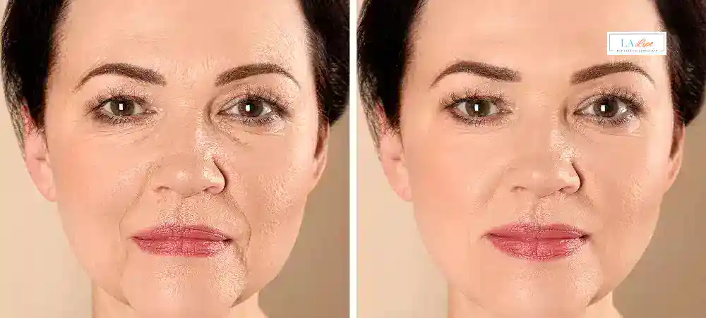 Why Aren’t My Skincare Products Making My Sagging Skin Look Firmer Wembley?