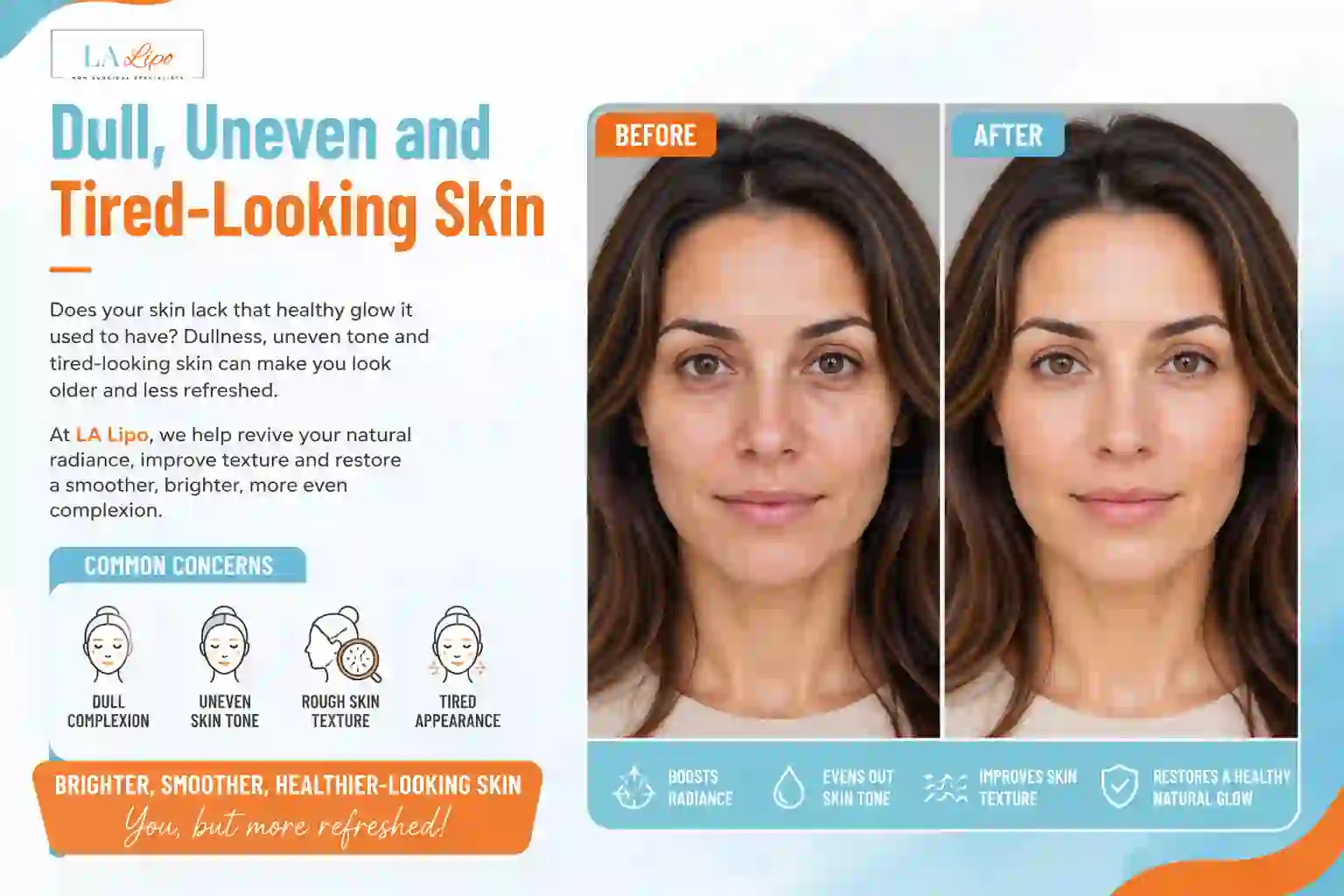 Sign #5: Dull, Uneven and Tired-Looking Skin Wembley