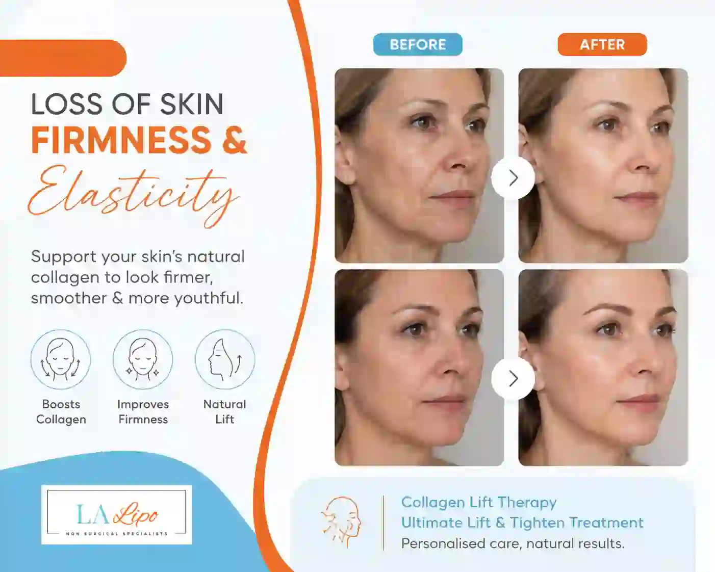 Sign #7: Loss of Skin Firmness and Elasticity Wembley